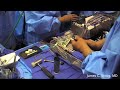 Distal Humerus Giant Cell Tumor Resection-Part 5