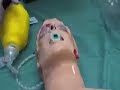 Airway adjuncts on resus.com.au