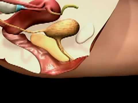 how to know where the g spot is