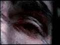 Ver Video