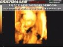 GRAVIMAGEM 112 excelente (ULTRA-SOM GESTAÇÃO 3D 4D 22 SEMANAS) GRAVIMAGEM 112 excelente (ULTRA-SOM GESTAÇÃO 3D 4D 22 SEMANAS)