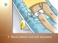 PostCare-Urinary-Cen