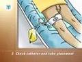 PostCare™ Urinary Center: Closed Urinary Drainage