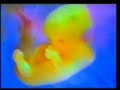 Mrekullia e Allahut - Placenta.