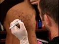 Miami Ink - Eating Disorder