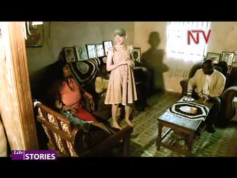 NTV Lifestories - Albinism pt 1