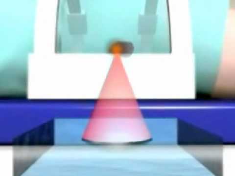 video-linktoworks-Uterine fibroids treatment Naturally