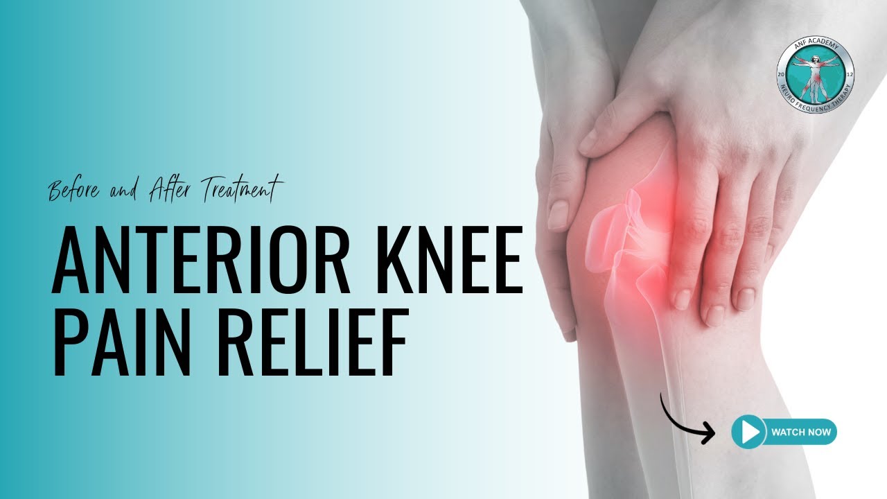 Set-Up Planning for a Double Blind RCT for Anterior Knee Pain | ANF Therapy®