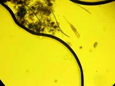 Platyhelminthes ROTIFEROS de água doce