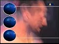 Thumbnail #1