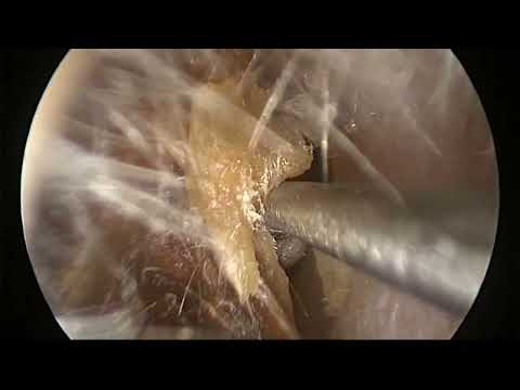 video-img