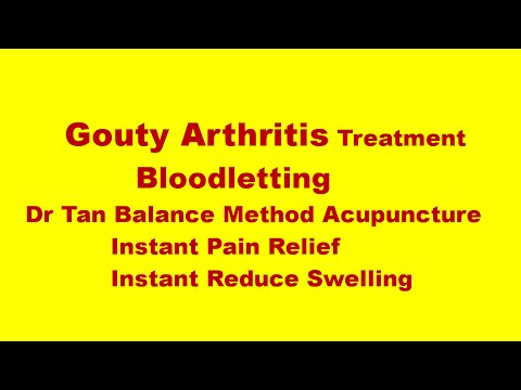 how to treat gouty arthritis