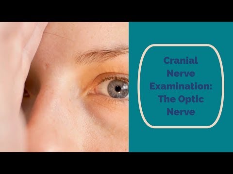 how to assess optic nerve