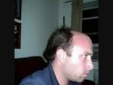 Flight of the Balding Head