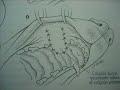 CIRUGIA CANINOS FISTULA ORONASAL CIRUGIA CANINOS FISTULA ORONASAL