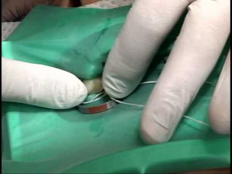 how to isolate eugenol