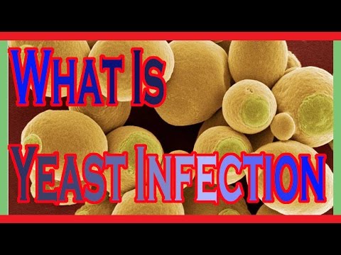 how to cure fungus in the body