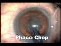 Intracorneal & Intracameral Quinolones for Endophthalmitis Prophylaxis