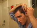 cauliflower ear is the nickname given to a hematoma occurring in the ear due to impact or rough abrasion.  the impact forces the skin from the cartilage and the resulting cavity fills with blood like a balloon.  the blood cannot circulate and eventually dies, also killing the cartilage, and thus, deforming the ear.

this can be prevented by draining the ear often, ice, and compression.  wear a head gear for a week or so until the ear can heal and you're good to go.

the 