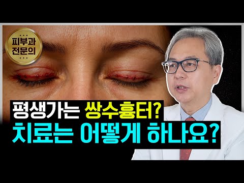 연세스타피부과 TV