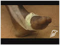 Thumbnail #1