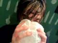 87: Jack Barakat breaks his nose stage diving