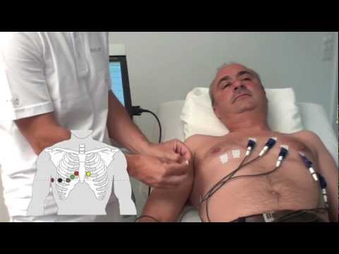 how to attach ecg electrodes