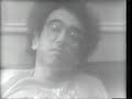 fridays-larry-david-as-a-plastic-surgeon.html