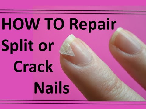 how to repair nails