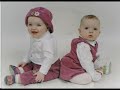 TSC Lives Tuberous Sclerosis