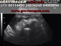 GRAVIMAGEM 28 GRAVIMAGEM 28