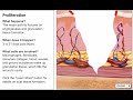 Wound Healing Process Wound Healing Process