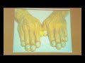 Demo of EMDR Pro software on BBC2\ Demo of EMDR Pro software on BBC2\