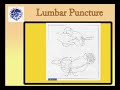 Pediatric Lumbar puncture