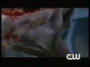 Supernatural 4.04 Metamorphosis Clip