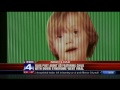 Down syndrome:&nbsp;Down Syndrome parents at Fox4