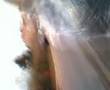 biloute saussisson