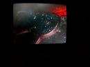 morgellons-chin-hair-with-tube-part-1-10x-60x-200x-mag.html