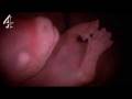 Animals In The Womb | Canine Embryo | Channel 4