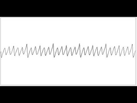 Basic Wavesequencing