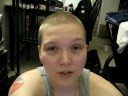 This video discusses pustules and the act of lancing them :D This video discusses pustules and the act of lancing them :D