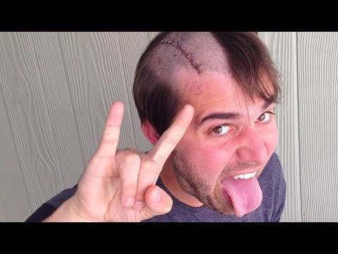 BRAIN SURGEAVERSARY!