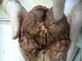 The-Brain