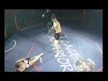 Kickboxing broken leg Kickboxing broken leg