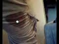 thumb tack in leg