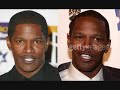 Celebrities And Undetectable Wigs