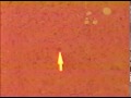 Toxoplasma-gondii