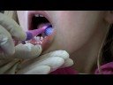 toothbrushing for children