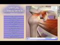 videos de Orthopaedic Patient Education 3D Software in HD