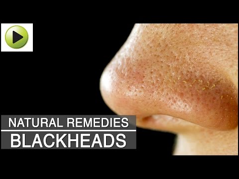 how to cure blackheads